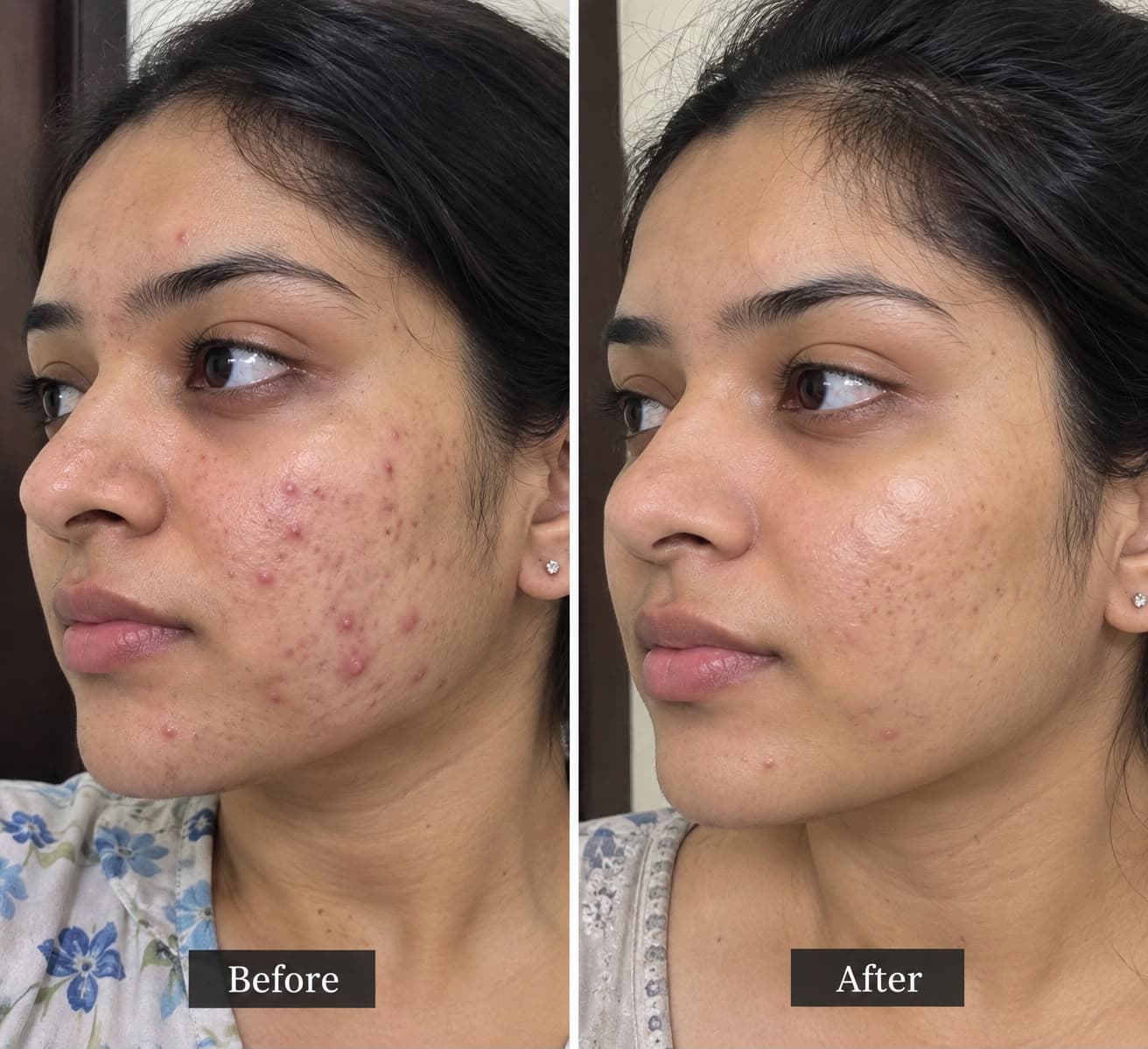 Customer before and after skincare results