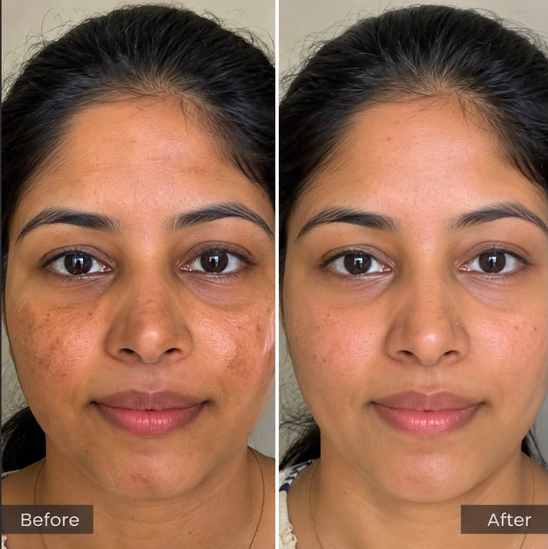 Customer before and after skincare results