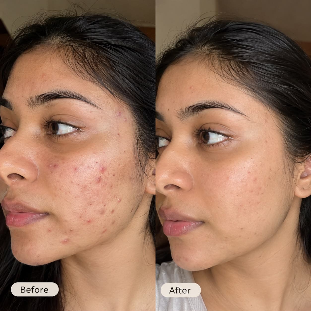 Customer before and after skincare results
