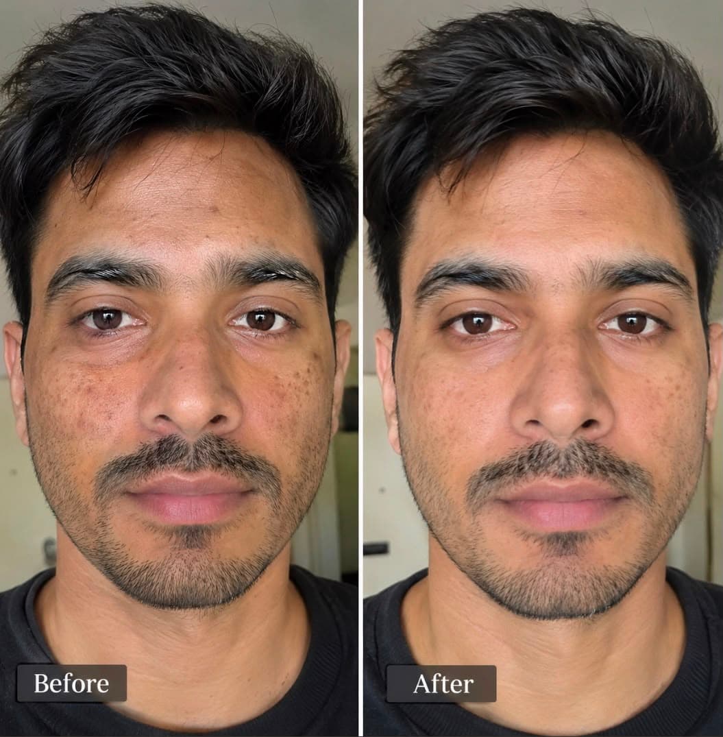 Customer before and after skincare results